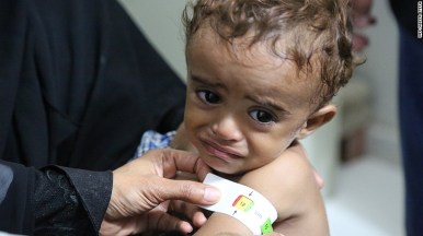 161028131814-yemen-starvation-exlarge-169.jpg